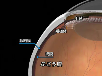 ぶどう膜炎