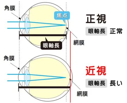 禁止