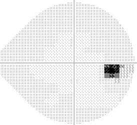 図4：視野検査